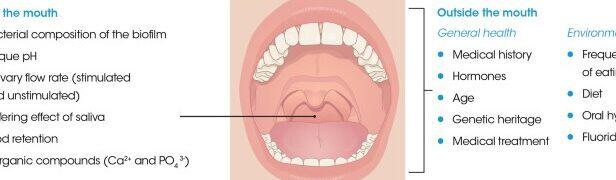 Tanden Tips - Gebitsreiniging