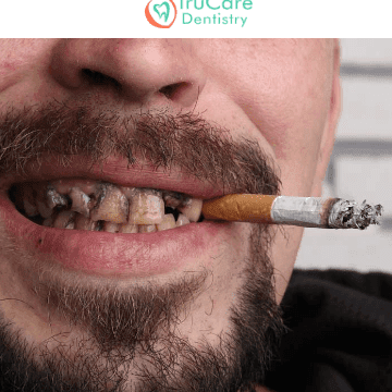 Tanden Tips - Gebitsreiniging