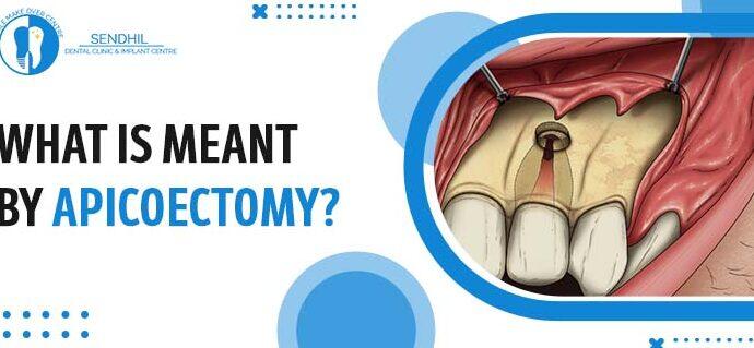 Tanden Tips - Endodontie Procedure