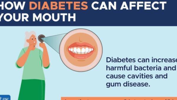 Tanden Tips - Tandenpoetsen Tips