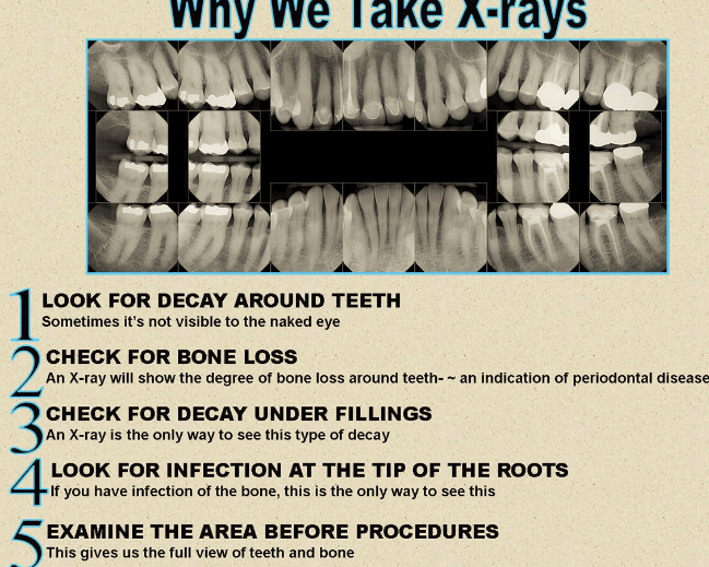 Tanden Tips - Endodontie Procedure