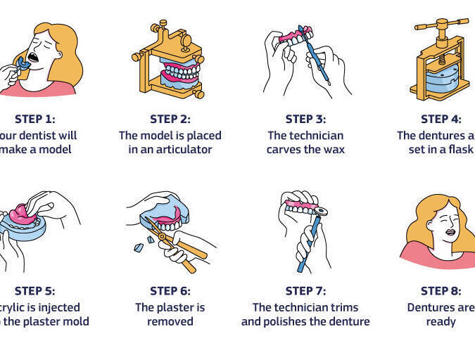 Tanden Tips - Gebitsprothese Laten Maken