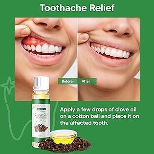 Tanden Tips - Ontstoken Kies