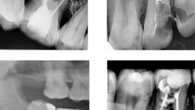 Tanden Tips - AI in Tandheelkunde