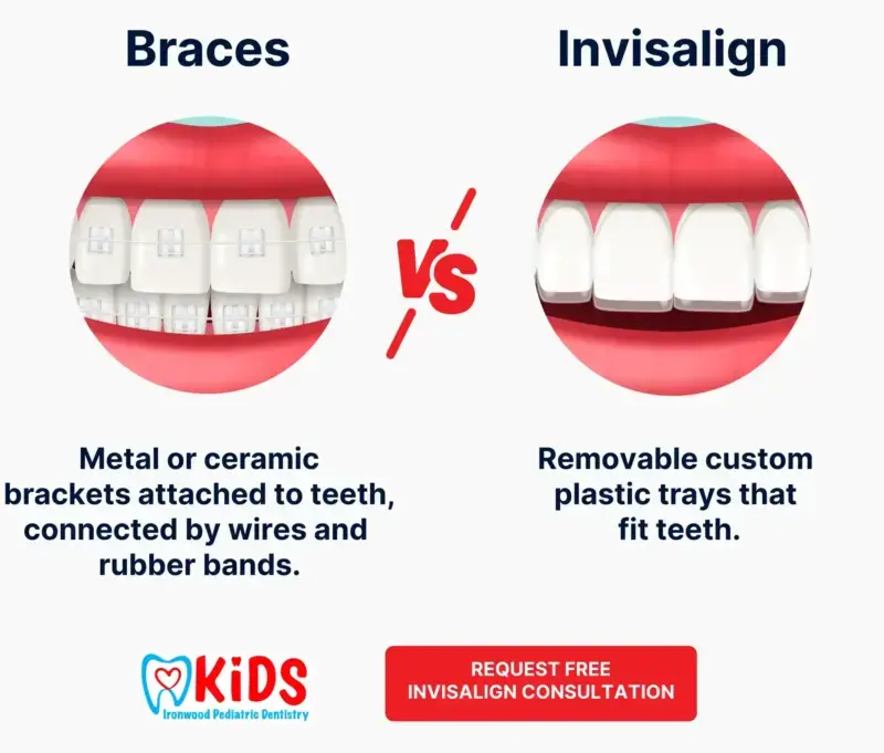 Tanden Tips - Invisalign