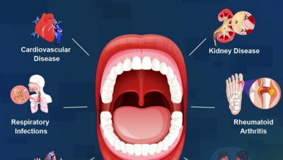 Tanden Tips - Mondgezondheid Meten