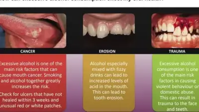 Tanden Tips - Ontstoken Kies