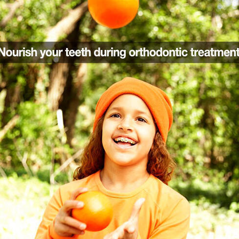 Tanden Tips - Orthodontie Kinderen