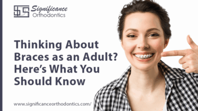 Tanden Tips - Permanente Beugel